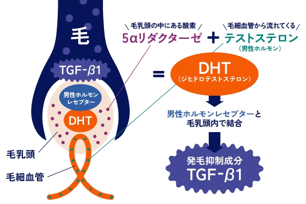 AGA（男性型脱毛症）とは