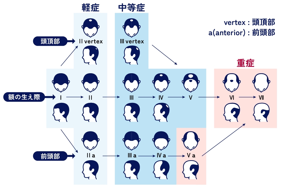 ハミルトン・ノーウッド分類